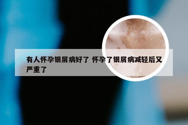 有人怀孕银屑病好了 怀孕了银屑病减轻后又严重了