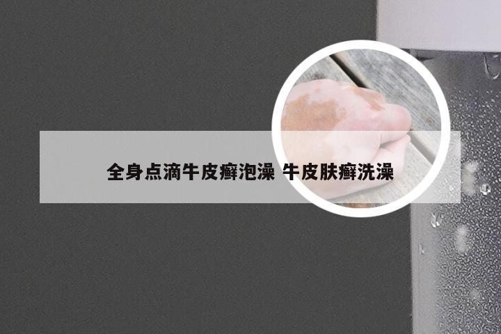 全身点滴牛皮癣泡澡 牛皮肤癣洗澡