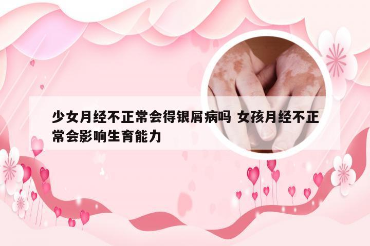 少女月经不正常会得银屑病吗 女孩月经不正常会影响生育能力