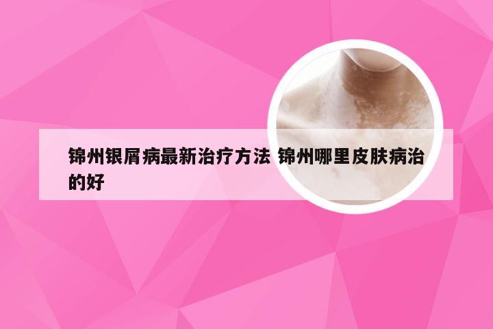 锦州银屑病最新治疗方法 锦州哪里皮肤病治的好