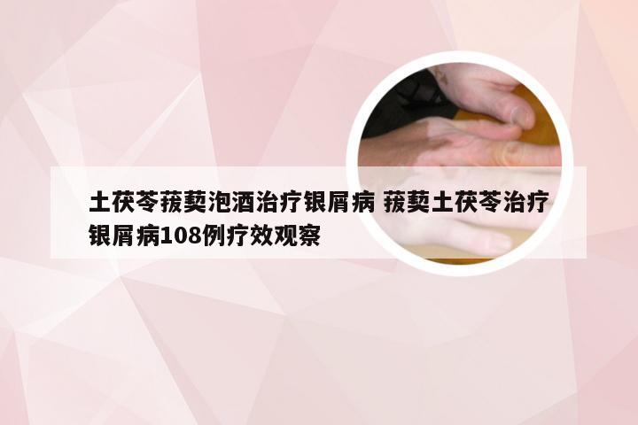 土茯苓菝葜泡酒治疗银屑病 菝葜土茯苓治疗银屑病108例疗效观察
