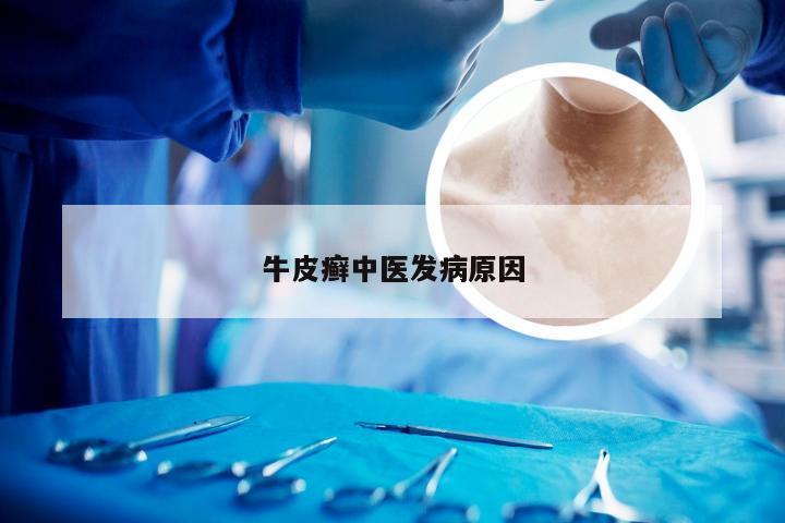 牛皮癣中医发病原因