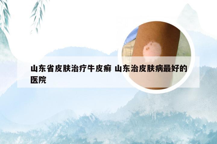 山东省皮肤治疗牛皮癣 山东治皮肤病最好的医院