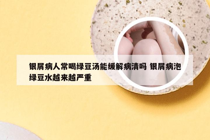 银屑病人常喝绿豆汤能缓解病清吗 银屑病泡绿豆水越来越严重