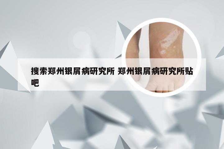 搜索郑州银屑病研究所 郑州银屑病研究所贴吧