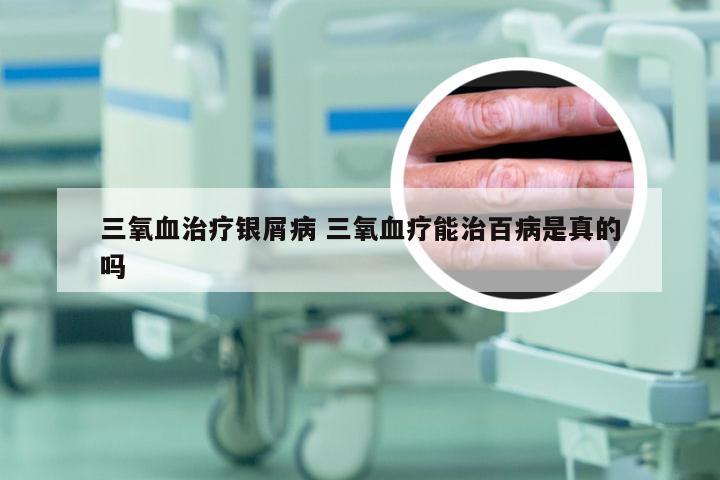 三氧血治疗银屑病 三氧血疗能治百病是真的吗
