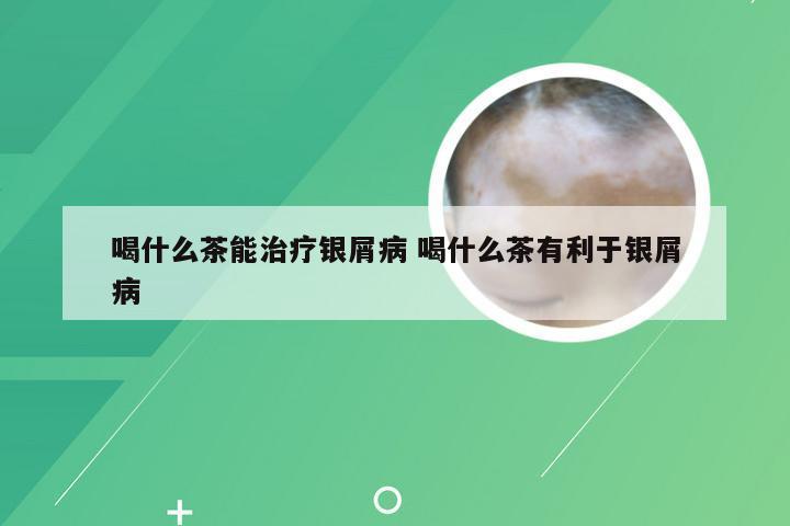 喝什么茶能治疗银屑病 喝什么茶有利于银屑病