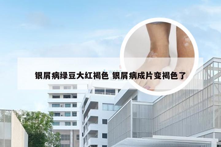 银屑病绿豆大红褐色 银屑病成片变褐色了