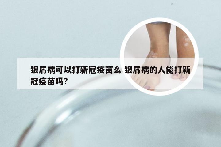 银屑病可以打新冠疫苗么 银屑病的人能打新冠疫苗吗?