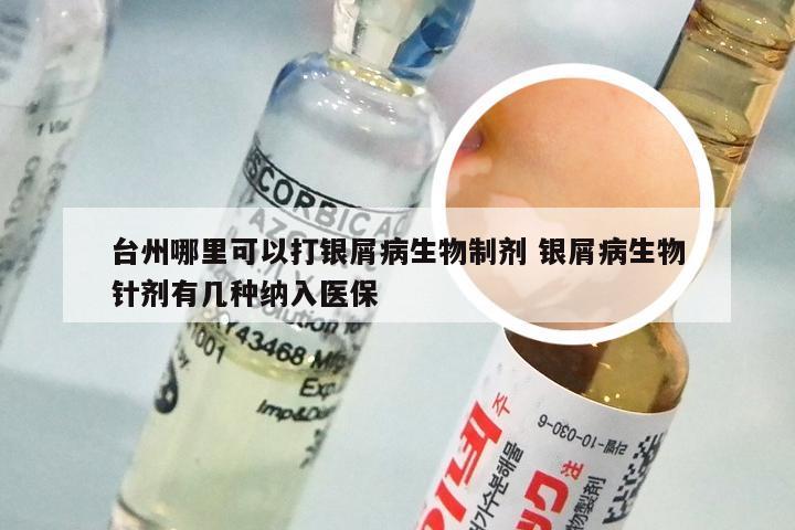 台州哪里可以打银屑病生物制剂 银屑病生物针剂有几种纳入医保