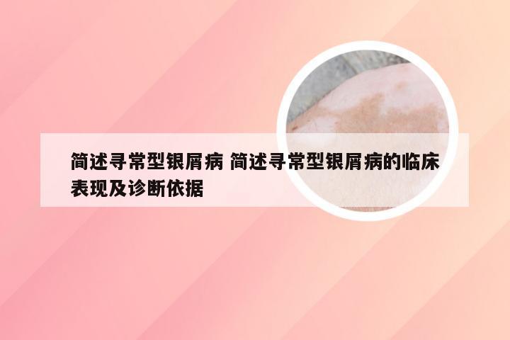 简述寻常型银屑病 简述寻常型银屑病的临床表现及诊断依据