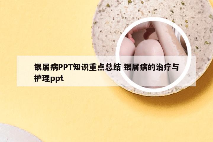 银屑病PPT知识重点总结 银屑病的治疗与护理ppt