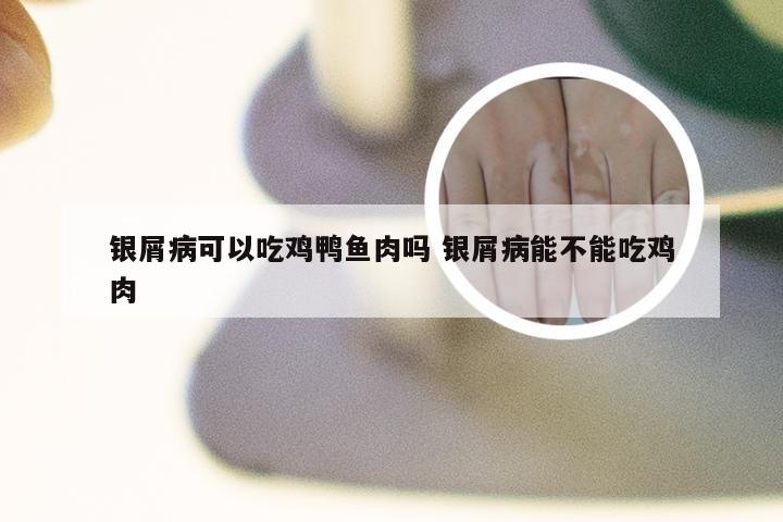 银屑病可以吃鸡鸭鱼肉吗 银屑病能不能吃鸡肉