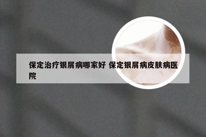 保定治疗银屑病哪家好 保定银屑病皮肤病医院