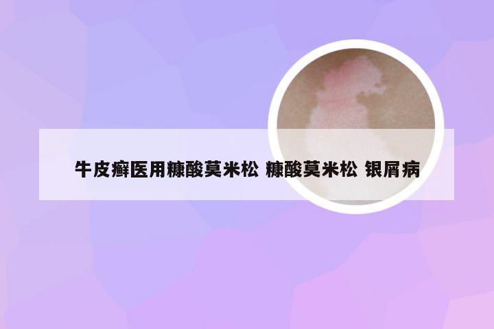 牛皮癣医用糠酸莫米松 糠酸莫米松 银屑病