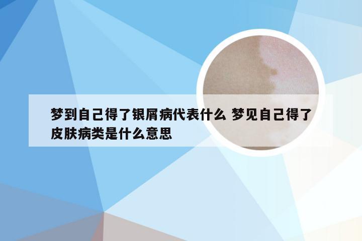 梦到自己得了银屑病代表什么 梦见自己得了皮肤病类是什么意思