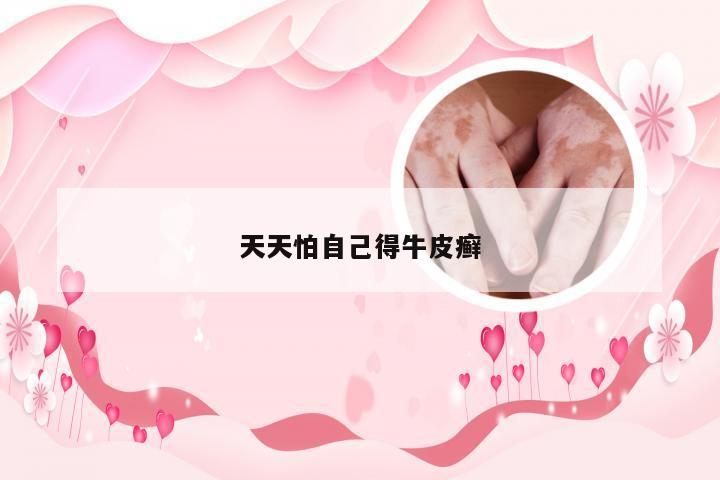 天天怕自己得牛皮癣