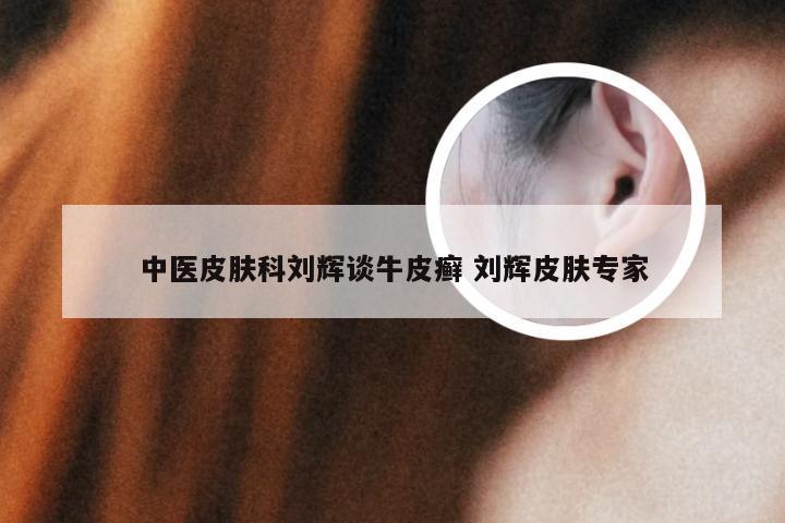 中医皮肤科刘辉谈牛皮癣 刘辉皮肤专家