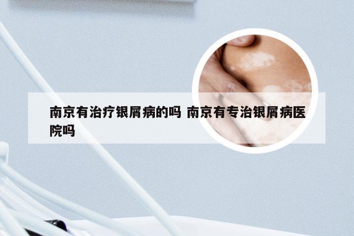 南京有治疗银屑病的吗 南京有专治银屑病医院吗