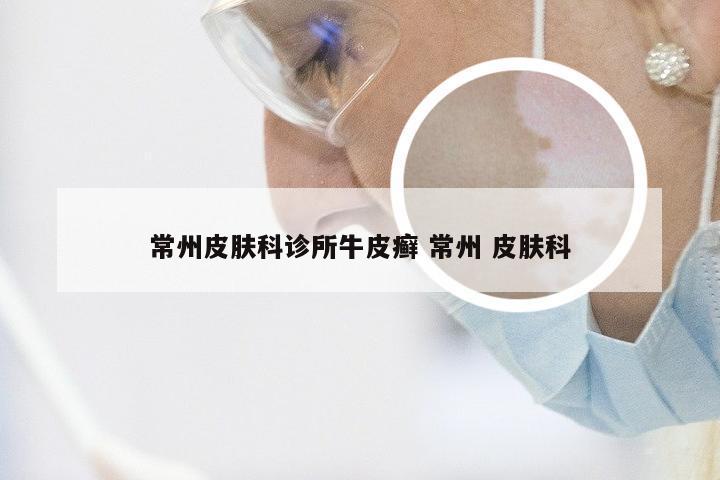 常州皮肤科诊所牛皮癣 常州 皮肤科