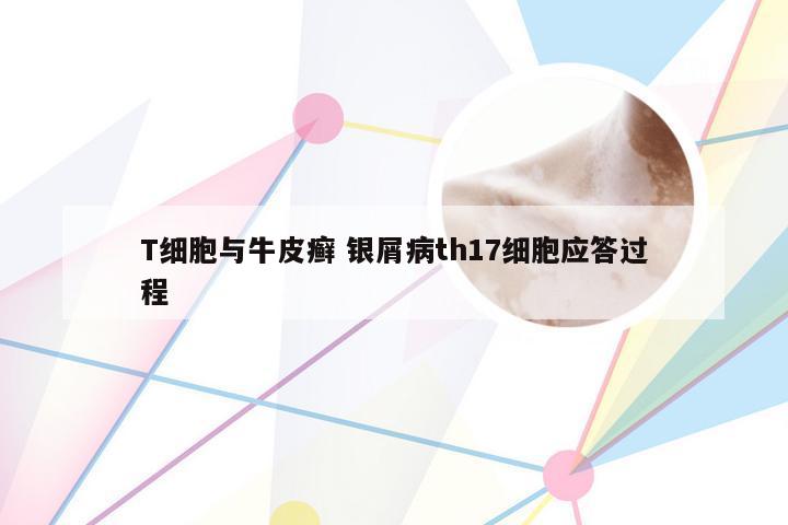 T细胞与牛皮癣 银屑病th17细胞应答过程