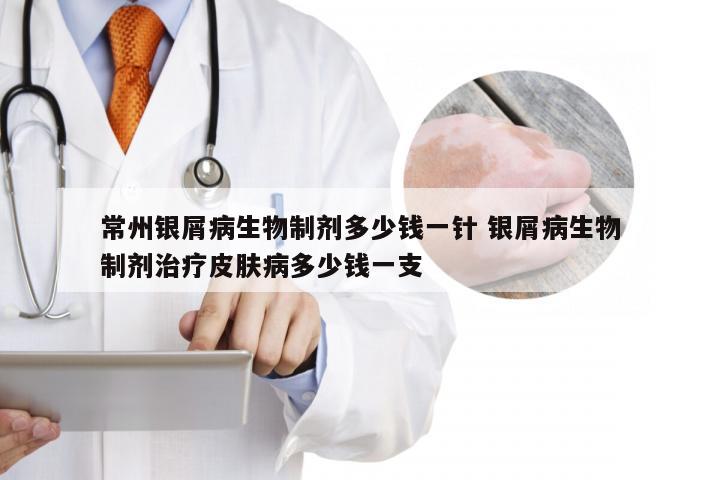 常州银屑病生物制剂多少钱一针 银屑病生物制剂治疗皮肤病多少钱一支