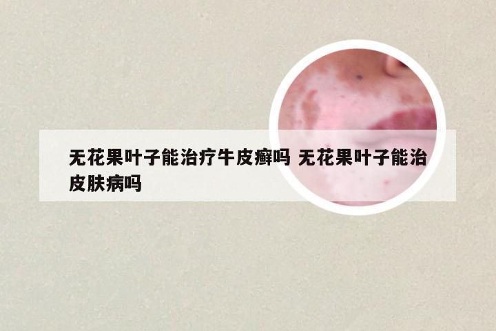 无花果叶子能治疗牛皮癣吗 无花果叶子能治皮肤病吗