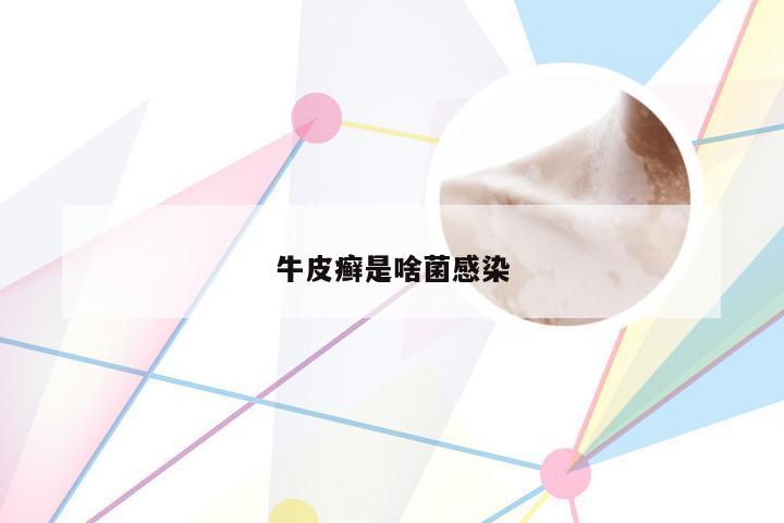 牛皮癣是啥菌感染