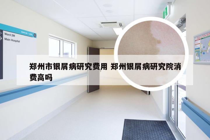 郑州市银屑病研究费用 郑州银屑病研究院消费高吗