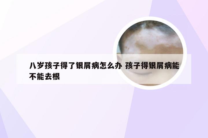 八岁孩子得了银屑病怎么办 孩子得银屑病能不能去根