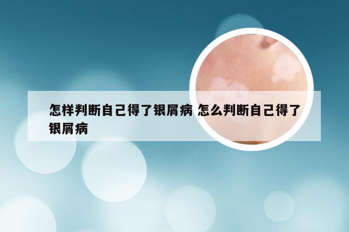 怎样判断自己得了银屑病 怎么判断自己得了银屑病