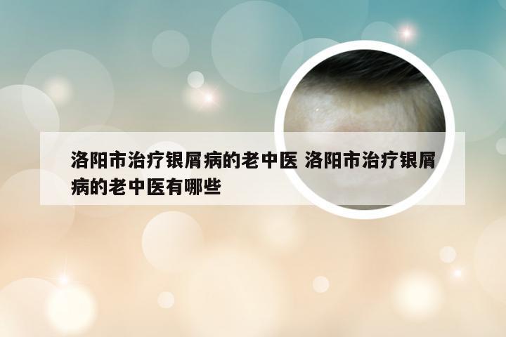 洛阳市治疗银屑病的老中医 洛阳市治疗银屑病的老中医有哪些