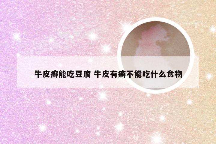 牛皮癣能吃豆腐 牛皮有癣不能吃什么食物
