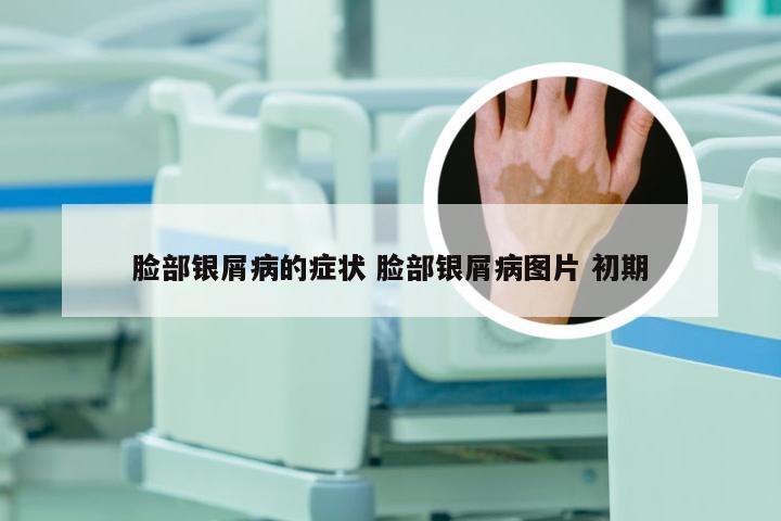 脸部银屑病的症状 脸部银屑病图片 初期