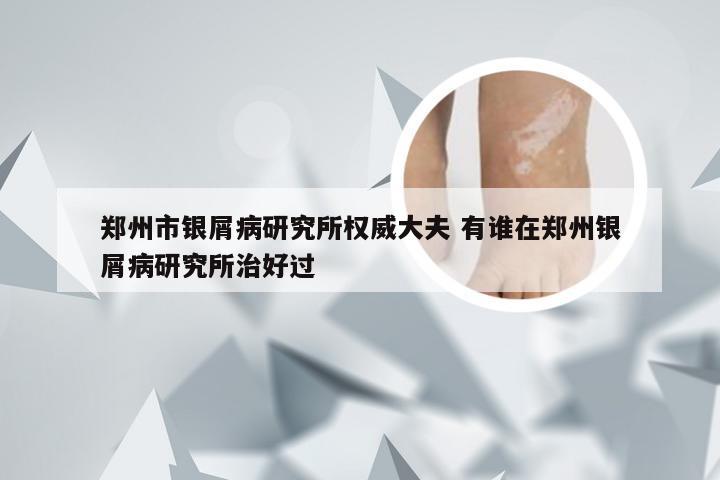 郑州市银屑病研究所权威大夫 有谁在郑州银屑病研究所治好过