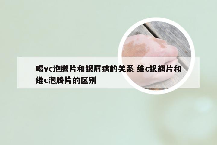 喝vc泡腾片和银屑病的关系 维c银翘片和维c泡腾片的区别