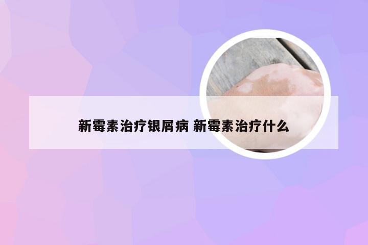 新霉素治疗银屑病 新霉素治疗什么
