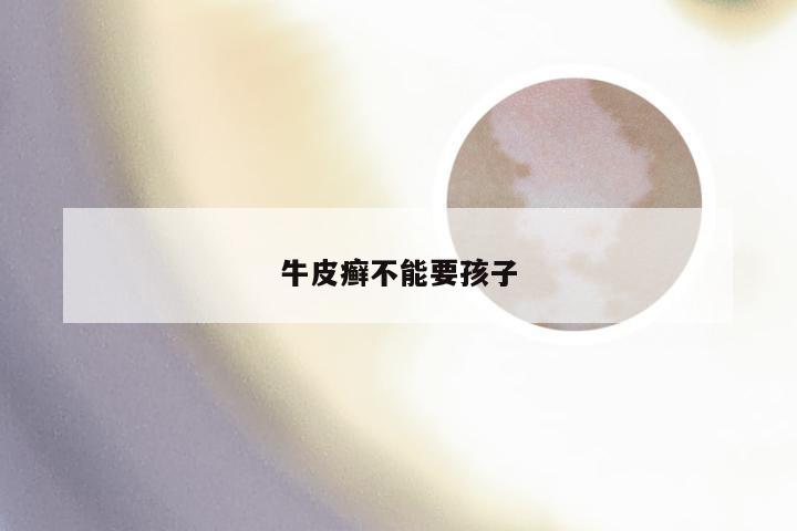 牛皮癣不能要孩子