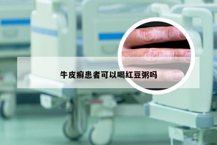 牛皮癣患者可以喝红豆粥吗