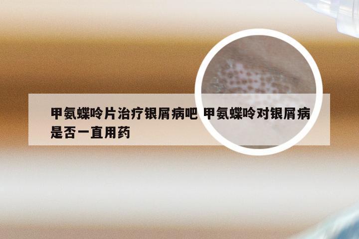甲氨蝶呤片治疗银屑病吧 甲氨蝶呤对银屑病是否一直用药