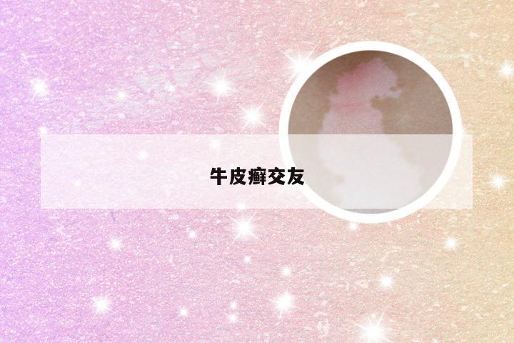 牛皮癣交友