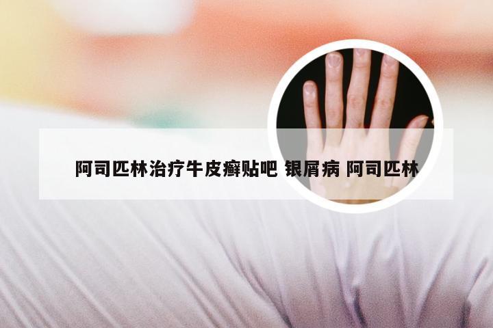 阿司匹林治疗牛皮癣贴吧 银屑病 阿司匹林
