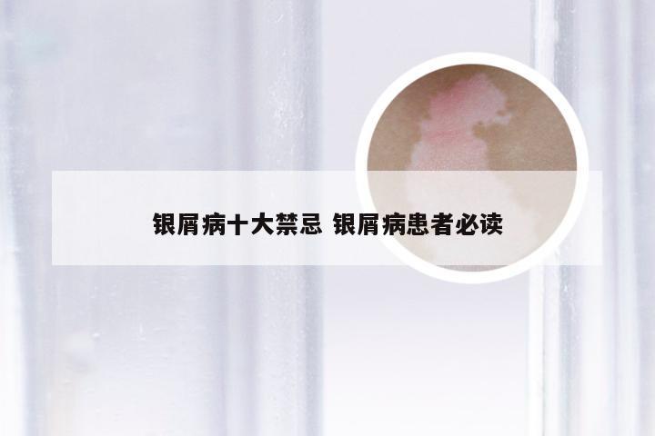 银屑病十大禁忌 银屑病患者必读