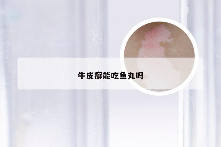 牛皮癣能吃鱼丸吗
