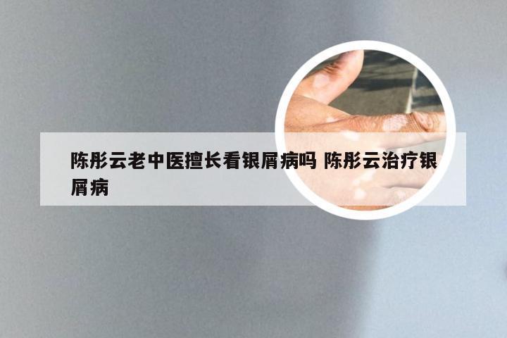 陈彤云老中医擅长看银屑病吗 陈彤云治疗银屑病