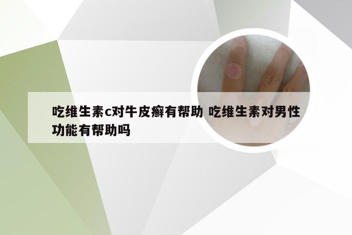 吃维生素c对牛皮癣有帮助 吃维生素对男性功能有帮助吗