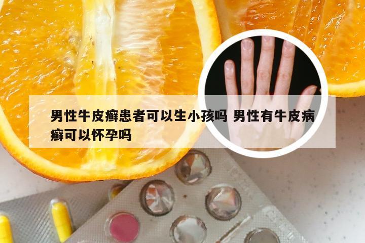 男性牛皮癣患者可以生小孩吗 男性有牛皮病癣可以怀孕吗