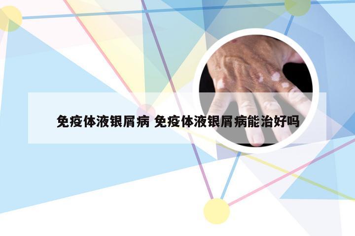 免疫体液银屑病 免疫体液银屑病能治好吗