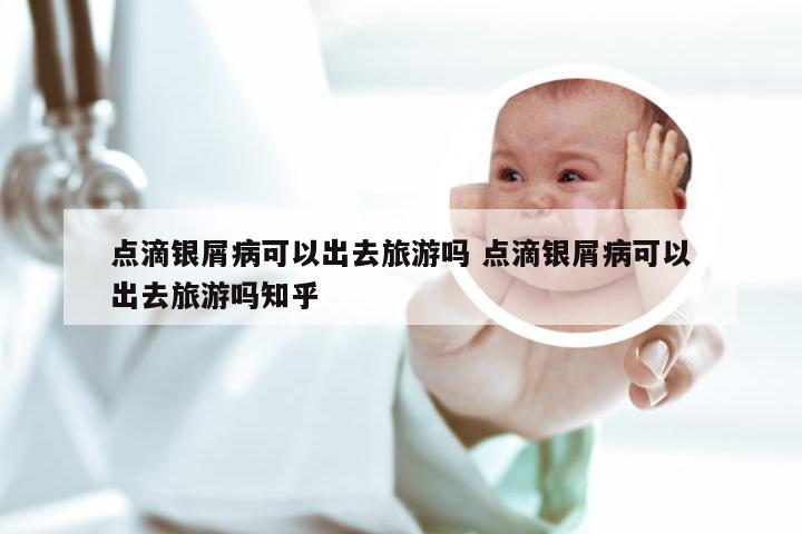 点滴银屑病可以出去旅游吗 点滴银屑病可以出去旅游吗知乎