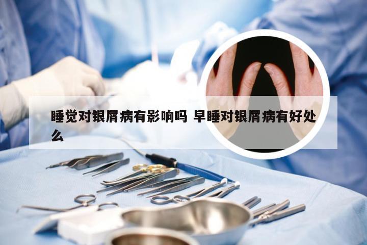 睡觉对银屑病有影响吗 早睡对银屑病有好处么